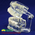 DENTAL11 (12571) Humano Adulto Natural Tamanho Transparente Padrão Dental Ensinar Modelos